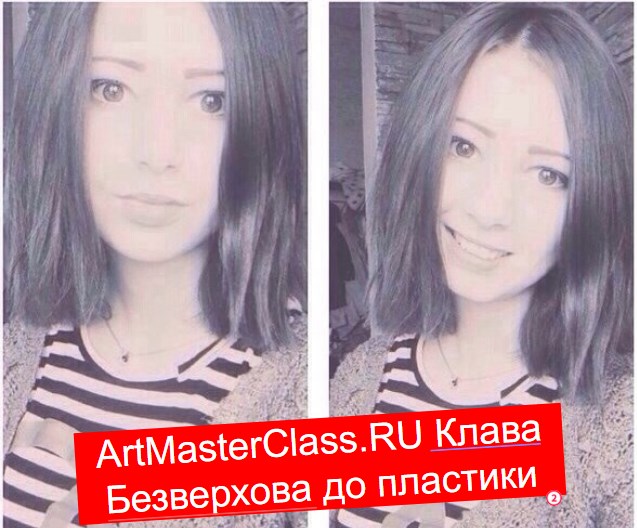 Клава Безверхова до пластики и после фото